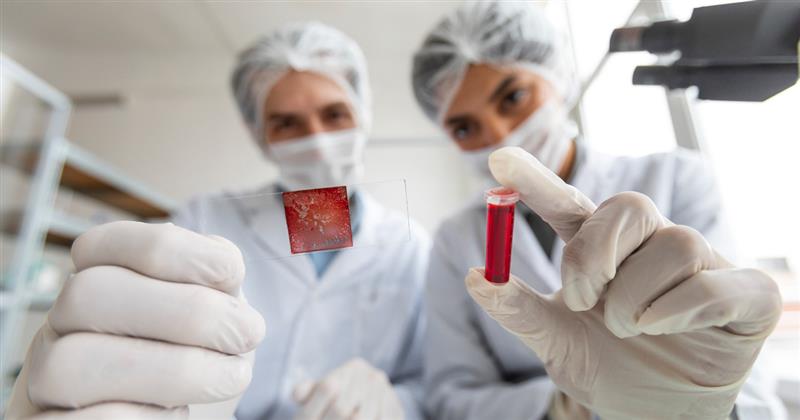 microcytic anemia icd 10